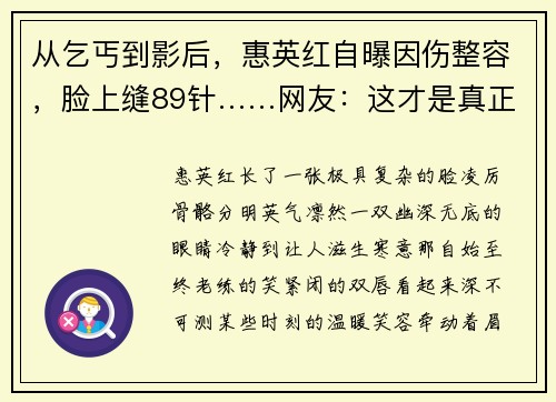 从乞丐到影后，惠英红自曝因伤整容，脸上缝89针……网友：这才是真正的换脸式演技！